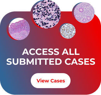 Banner quadrado com bordas arredondadas, no topo tem 4 bolinhas de tamanhos variados com imagens de lâminas de patologia, logo abaixo o texto 'ACCESS ALL SUBMITTED CASES' e por último um botão com o texto 'View Cases'