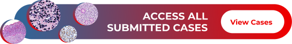 Banner fino como se fosse uma faixa, na esquerda tem 4 bolinhas de tamanhos variados com imagens de lâminas de patologia, ao centro o texto 'ACCESS ALL SUBMITTED CASES' e no lado direito um botão com o texto 'View Cases'